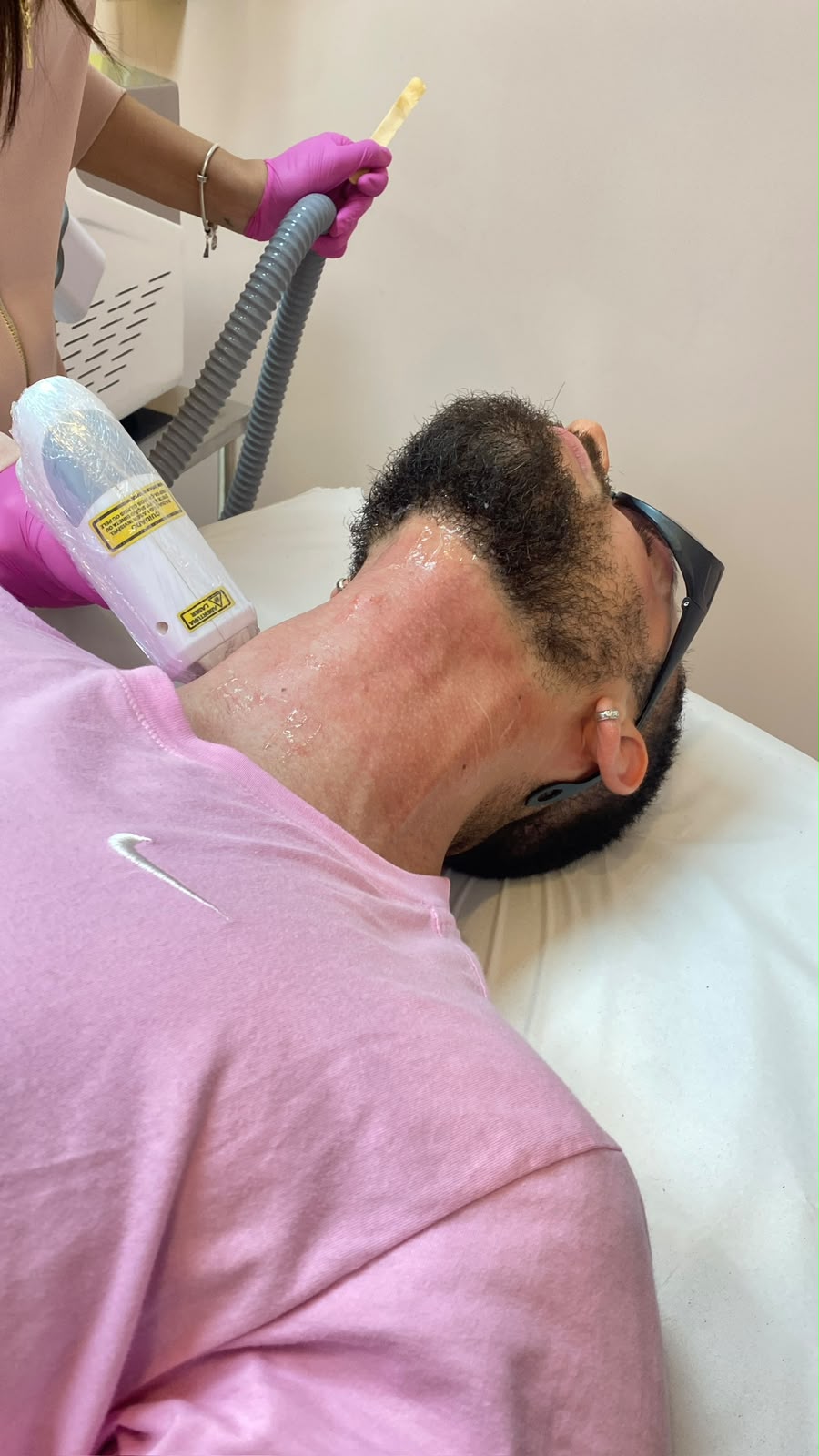 Homem realizando sessão de depilação a laser na barba na Diamond Estética